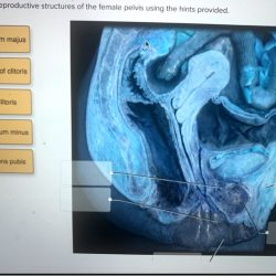 Label the reproductive structures of the female pelvis.