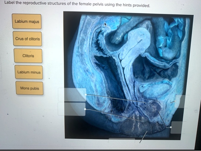 Label the reproductive structures of the female pelvis.