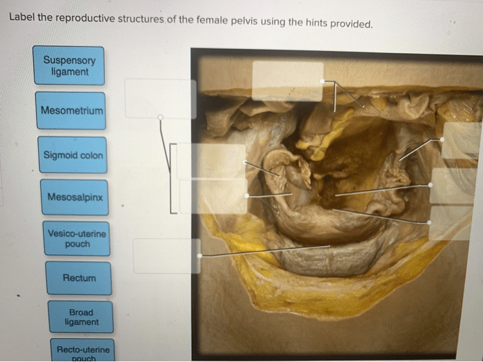 Label the reproductive structures of the female pelvis.