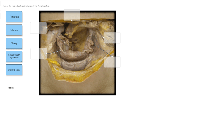 Female label reproductive structures ct scan pelvis hints provided using uterus vagina chegg fundus